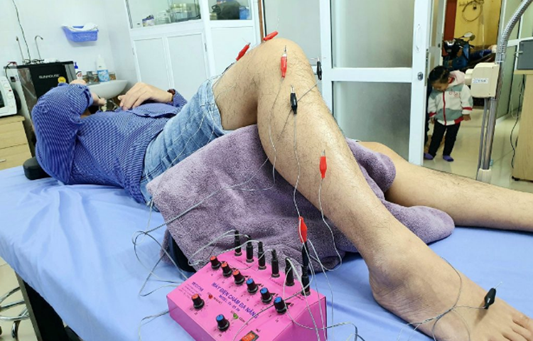 Điện mãng châm điều trị giảm đau do thoái hóa khớp (Chứng tý; Bế cốt tý)